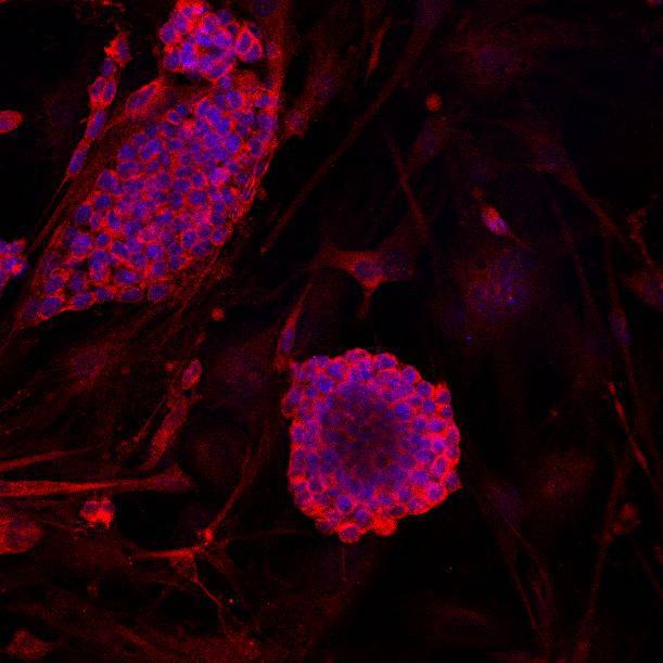 Anti-GAPDH Antibody (2N589)