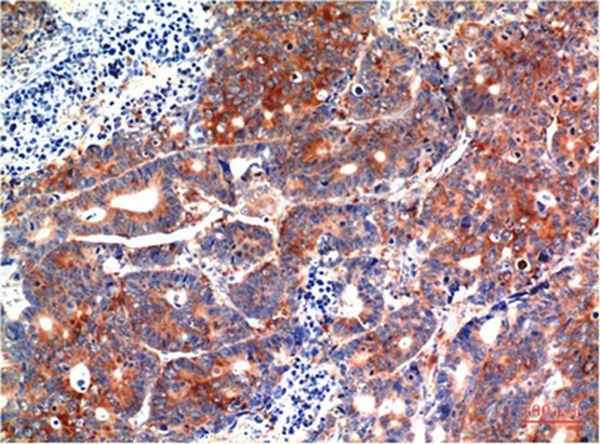 Anti-GSK3B Antibody (3M532)