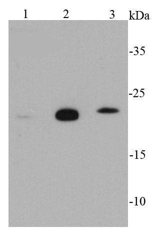 Anti-GPX1 Antibody (3M540)