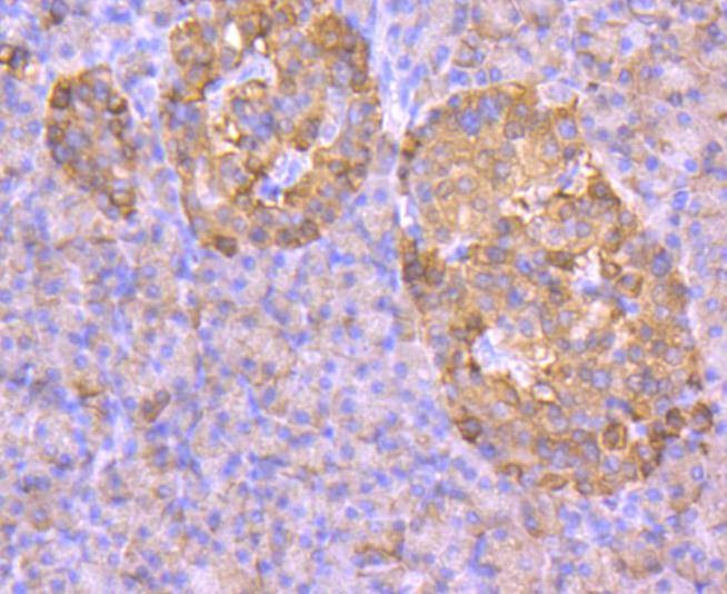 Anti-SLC2A2 Antibody (9R937)
