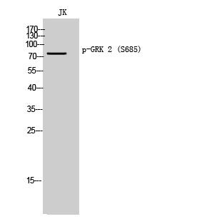 Anti-Phospho-GRK2 (Ser685) Polyclonal Antibody