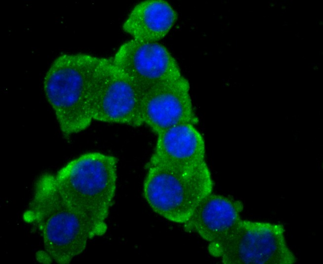 Anti-GRIA2 Antibody (8K502)