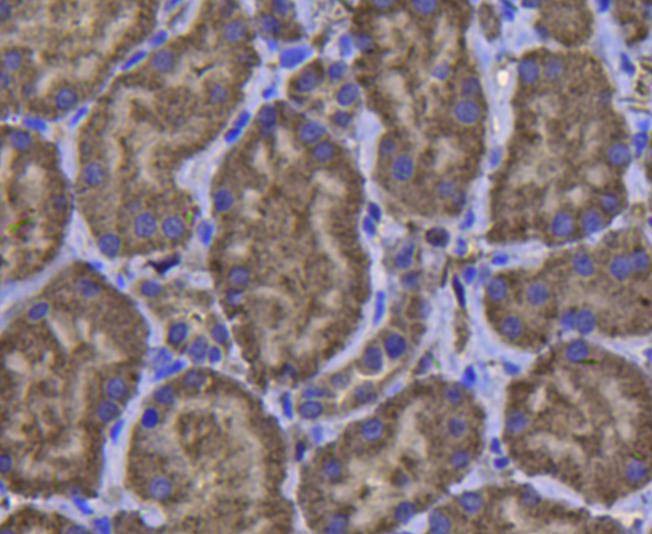 Anti-GPX1 Antibody (3M540)