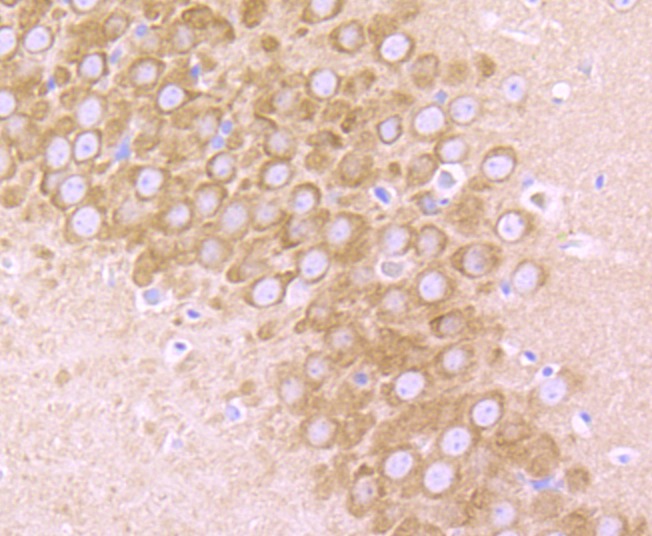 Anti-GRIA2 Antibody (8K502)