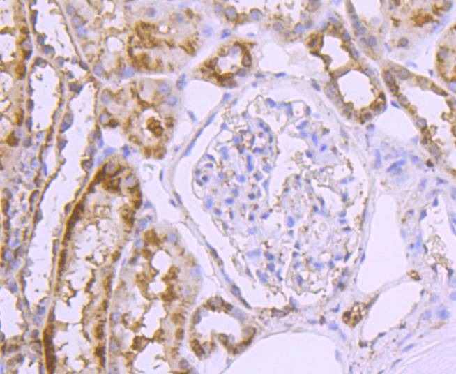 Anti-SLC2A2 Antibody (9R937)