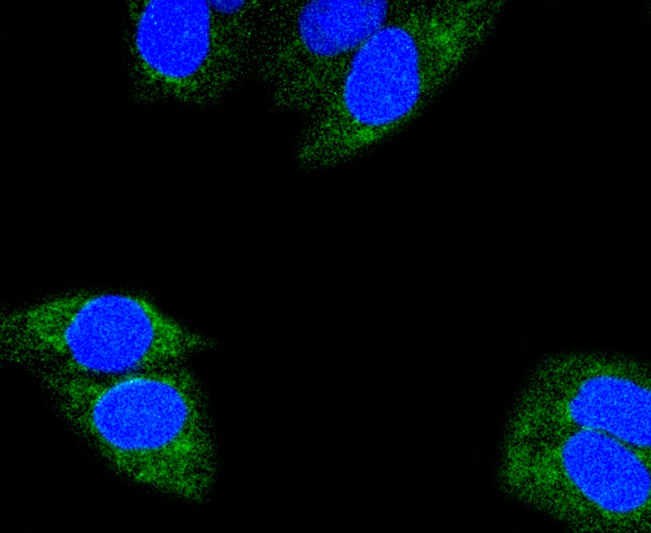 Anti-Glutaminase Antibody (8G424)