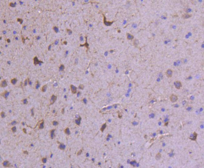 Anti-Glutamate receptor 1 Antibody (3G336)