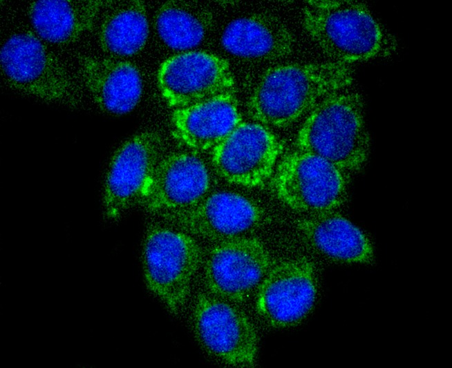 Anti-Glutaminase Antibody (8G424)
