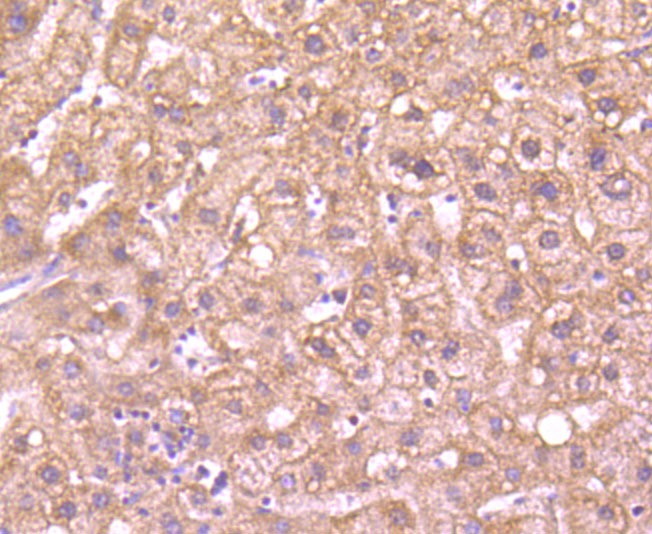 Anti-G6PD Antibody (4T578)
