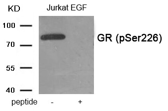 Anti-Phospho-NR3C1 (Ser226) Polyclonal Antibody