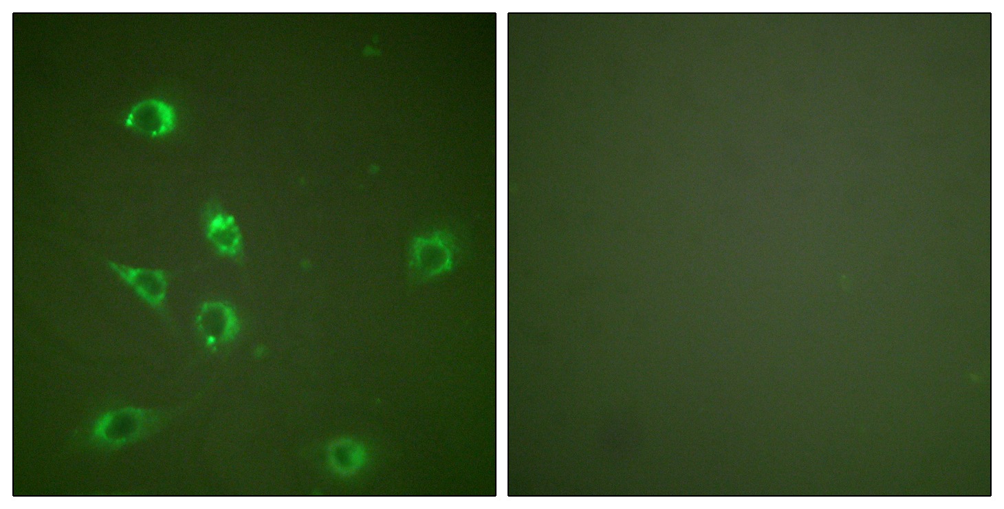 Anti-GCG Antibody (2S820)