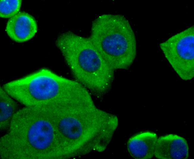Anti-G6PD Antibody (4T578)