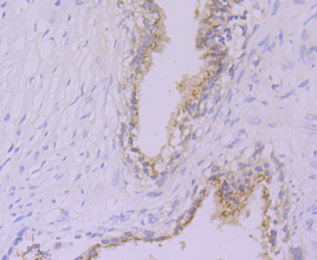 Anti-GPI Antibody (6K139)