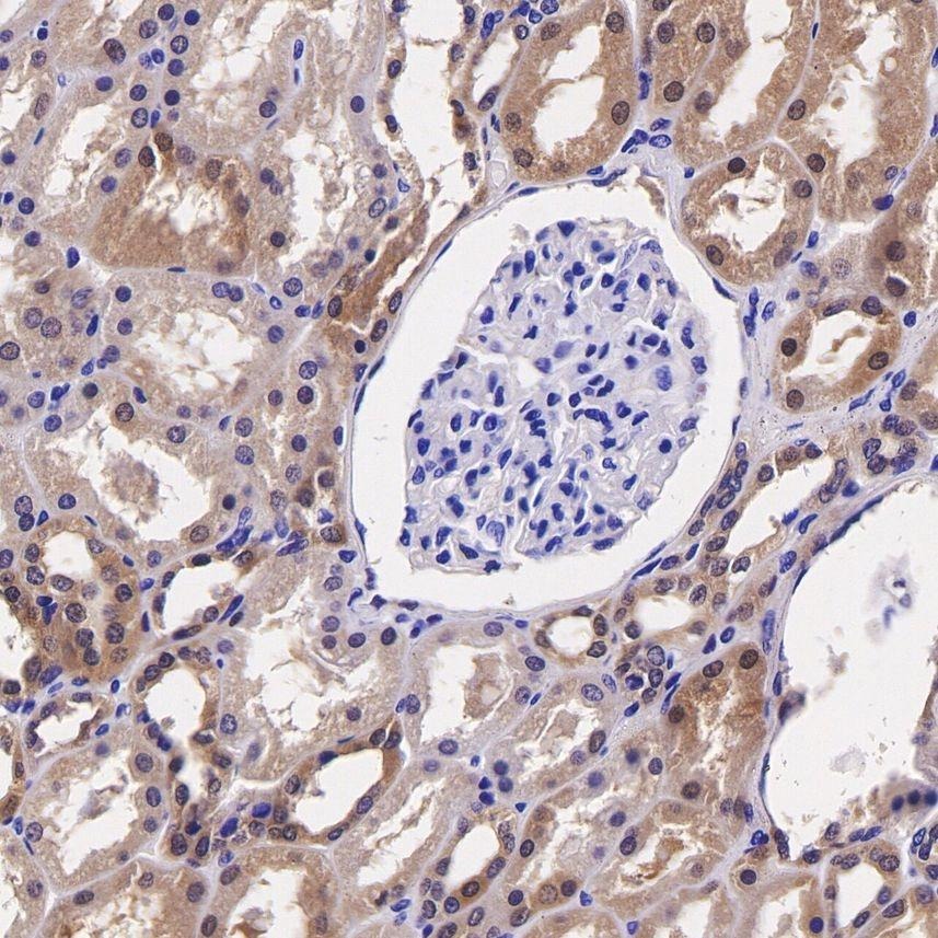 Anti-GPX4 Antibody (5M410)