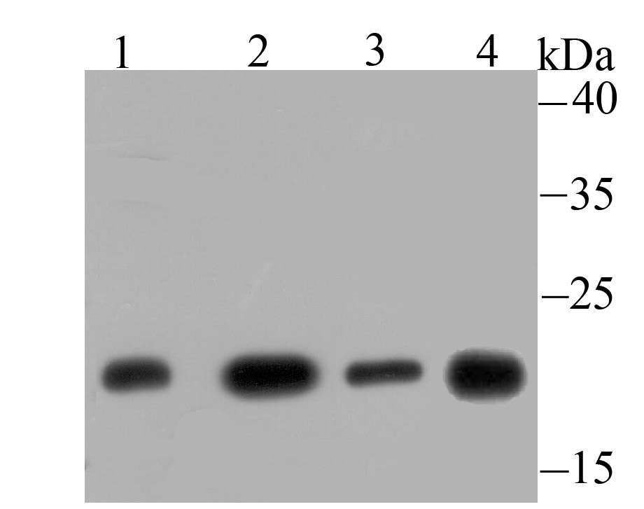 Anti-Lactoylglutathione lyase/GLO1 Antibody (8P849)
