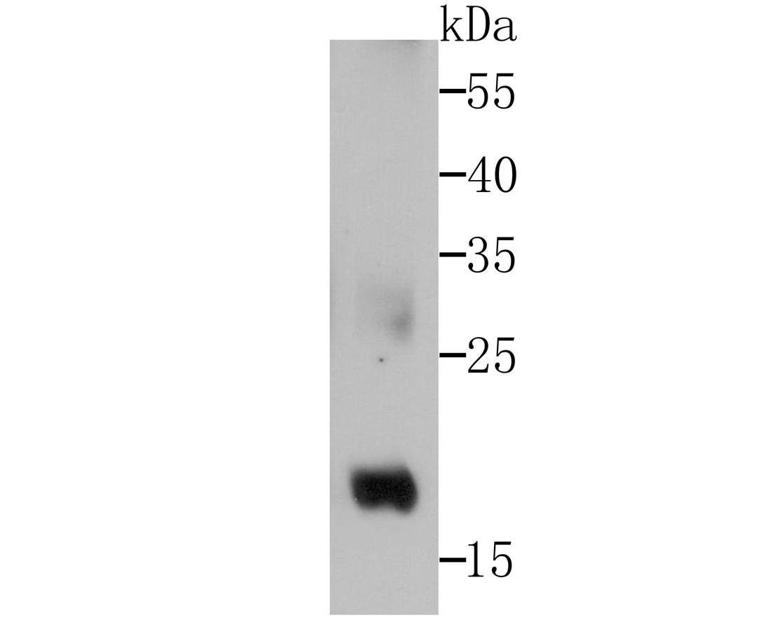 Anti-GPX4 Antibody (5M410)