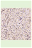 Anti-SLC2A1 Antibody (3P617)