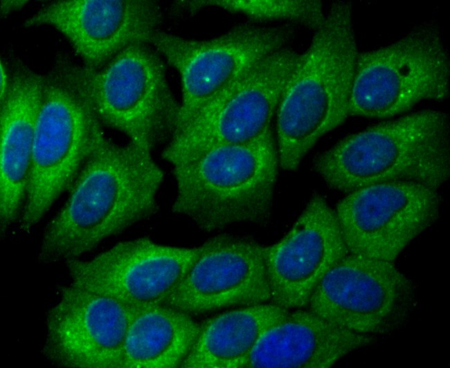 Anti-GPI Antibody (6K139)