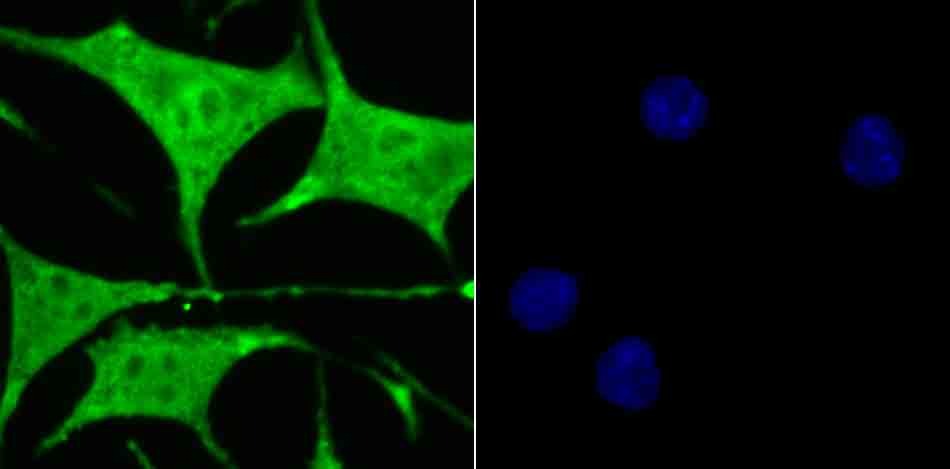 Anti-Lactoylglutathione lyase/GLO1 Antibody (8P849)