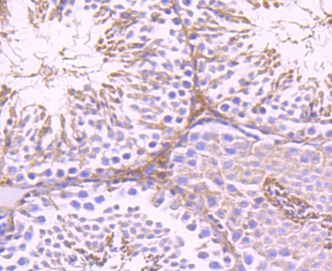 Anti-G6PD Antibody (4T578)