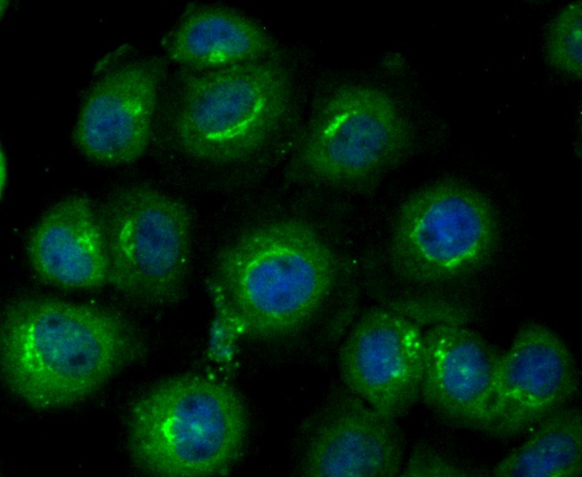 Anti-GPI Antibody (6K139)