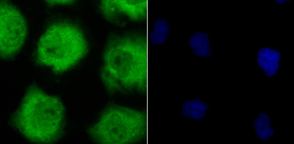 Anti-Lactoylglutathione lyase/GLO1 Antibody (8P849)