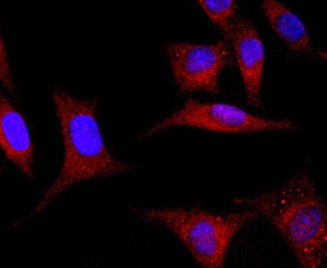 Anti-GLI1 Antibody (6E606)
