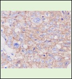 Anti-SLC2A1 Antibody (3P617)