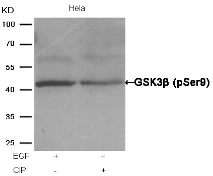 Anti-Phospho-GSK3B (Ser9) Polyclonal Antibody 2