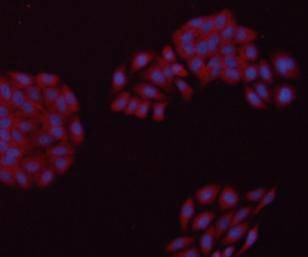 Anti-GAPDH Antibody (1V316)