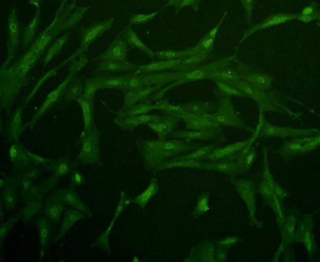 Anti-Glucose Transporter GLUT4 Antibody (9P565)