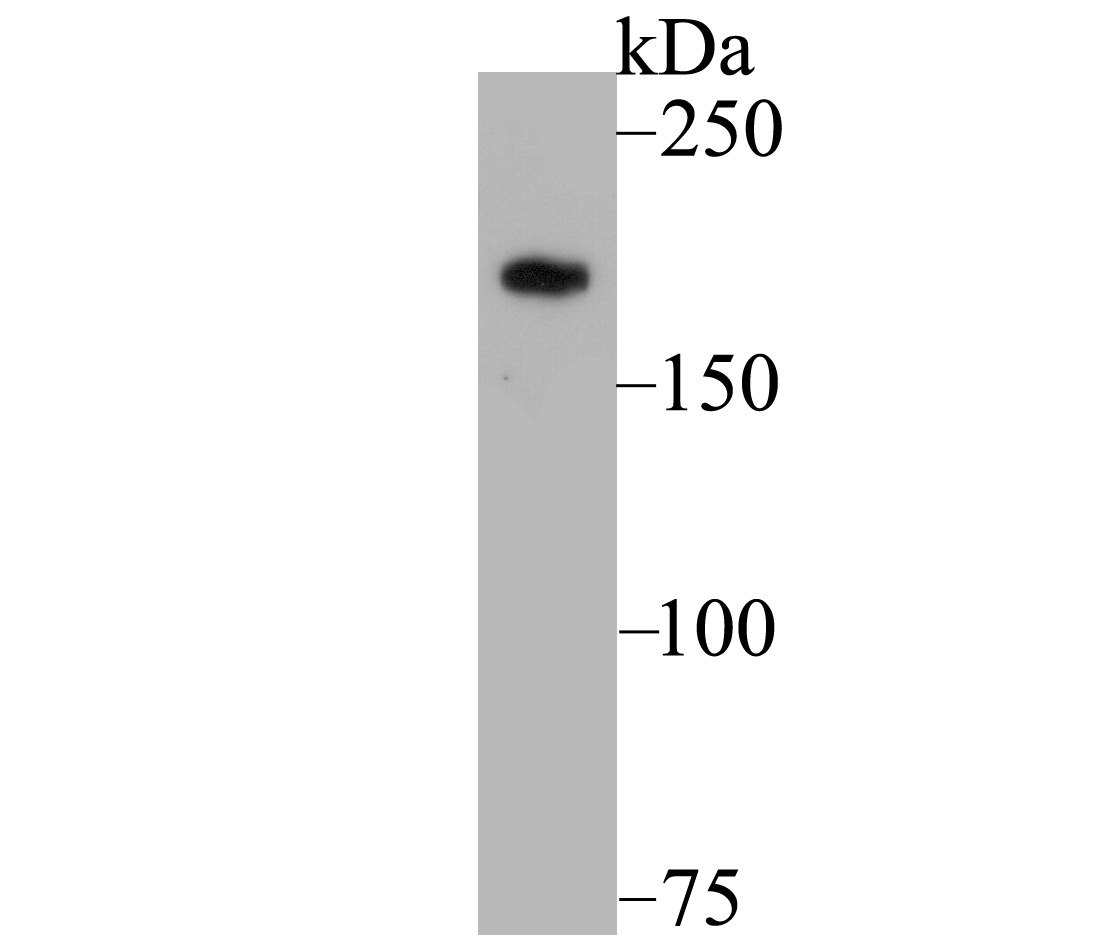 Anti-Gli3 Antibody (3M730)