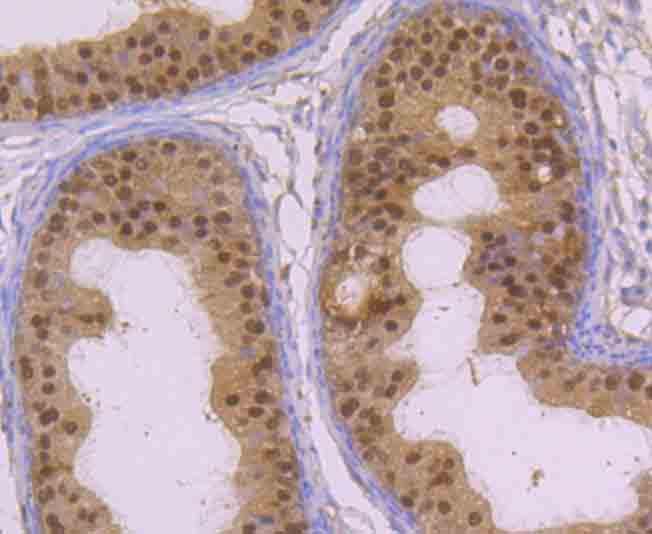 Anti-Lactoylglutathione lyase/GLO1 Antibody (8P849)
