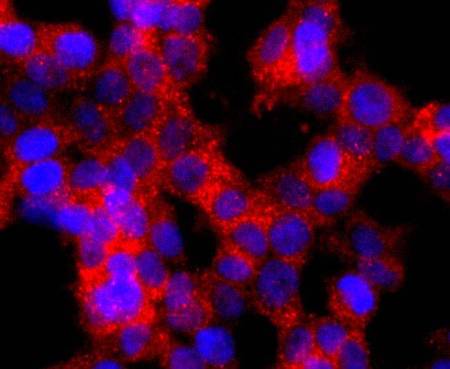 Anti-GLI1 Antibody (6E606)