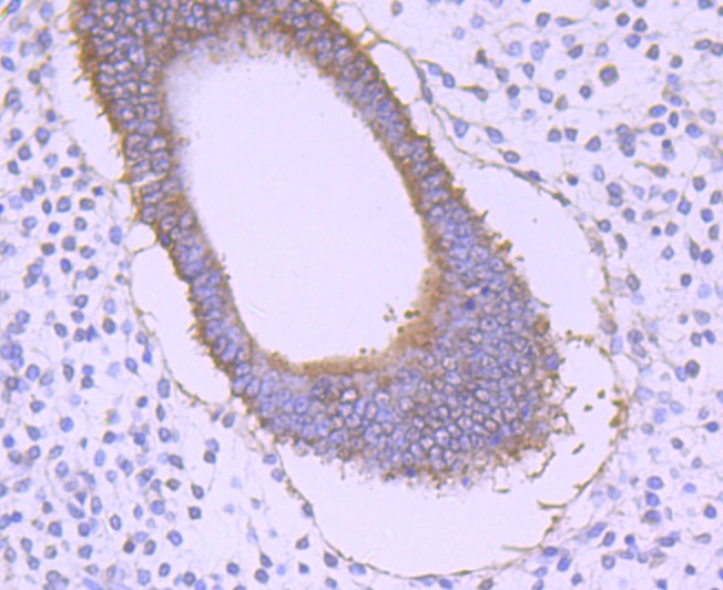 Anti-GRASP65 Antibody (9N637)