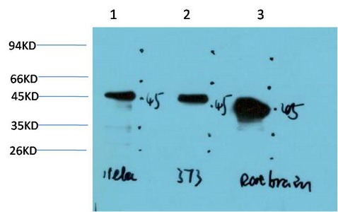 Anti-GSK3B Antibody (2C423)