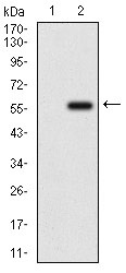 Anti-Osteoactivin/GPNMB Antibody (4G206)