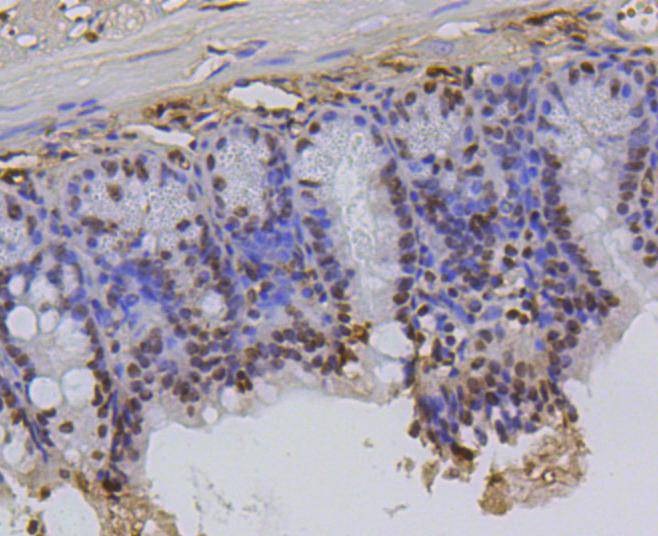 Anti-Hydroxyl-Histone H2A type 1-B/E (Tyr39) Antibody (3K640)