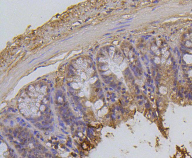 Anti-Acetyl-Histone H2A type 1-B/E (Lys9) Antibody (1M336)