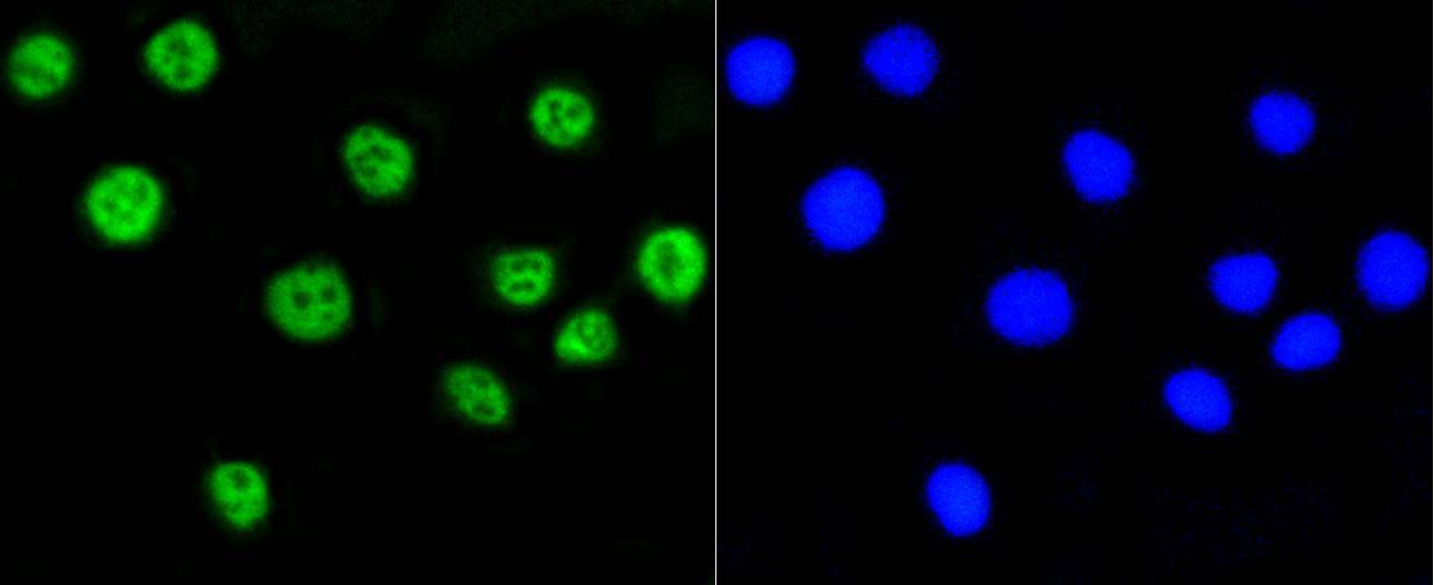 Anti-Acetyl-Histone H2A type 1-B/E (Lys9) Antibody (1M336)