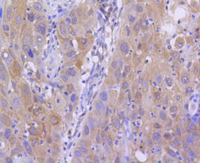 Anti-Acetyl-Histone H2A type 1-B/E (Lys9) Antibody (1M336)