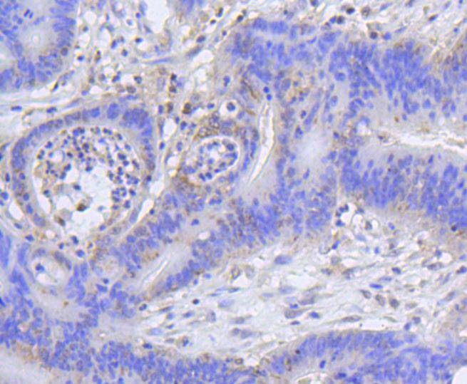 Anti-Acetyl-Histone H2A type 1-B/E (Lys9) Antibody (1M336)