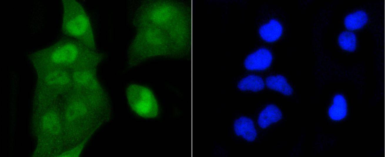 Anti-Acetyl-Histone H2A type 1-B/E (Lys9) Antibody (1M336)