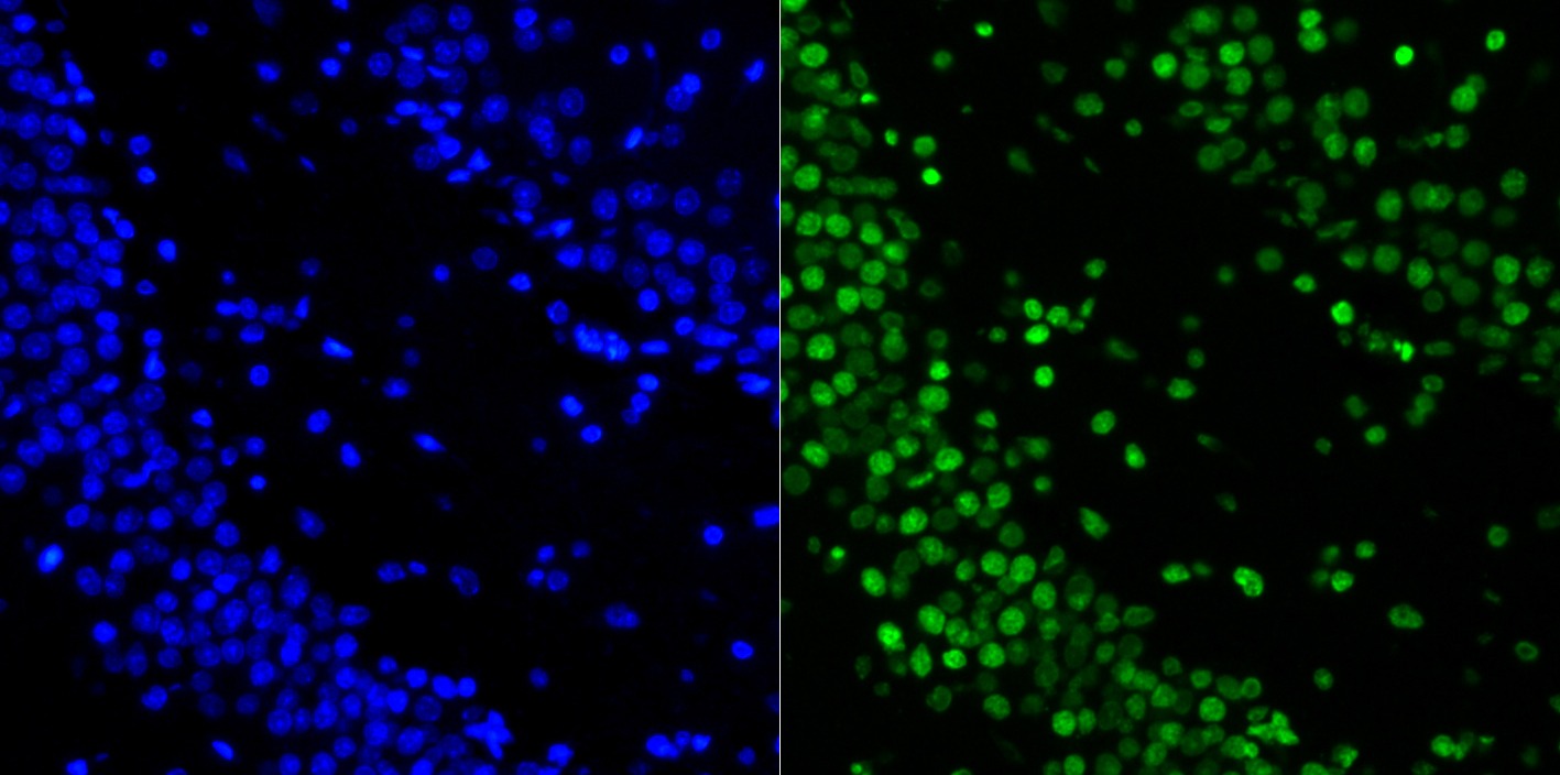 Anti-H2AFX Antibody (1G393)