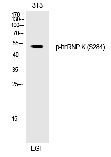 Anti-Phospho-HNRNPK (Ser284) Polyclonal Antibody