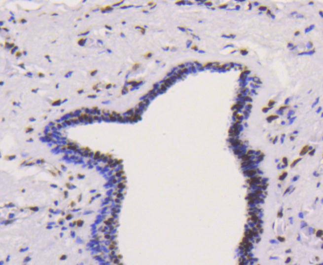 Anti-HNRNPK Antibody (5Q710)