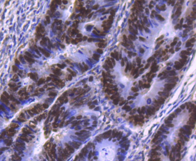 Anti-HNF4A Antibody (1Y813)