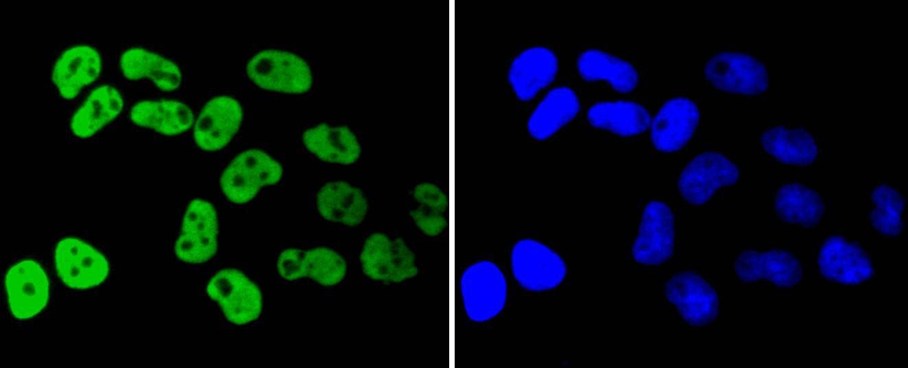 Anti-HNRNPK Antibody (5Q710)