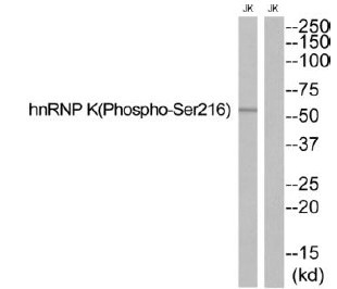 Anti-Phospho-HNRNPK (Ser216) Polyclonal Antibody