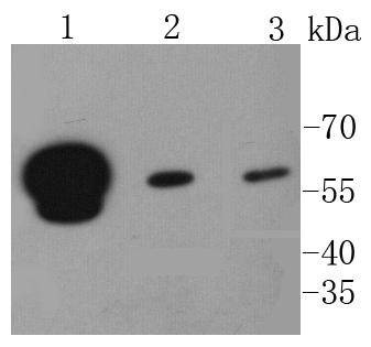 Anti-HNRNPK Antibody (5Q710)